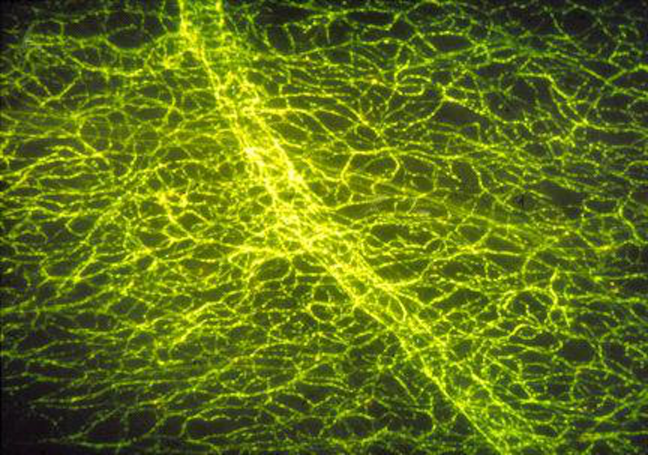 Noradrenalin enthaltende Nervenzellen, die die Muskeln und Blutgefäße in der Iris des Auges versorgen